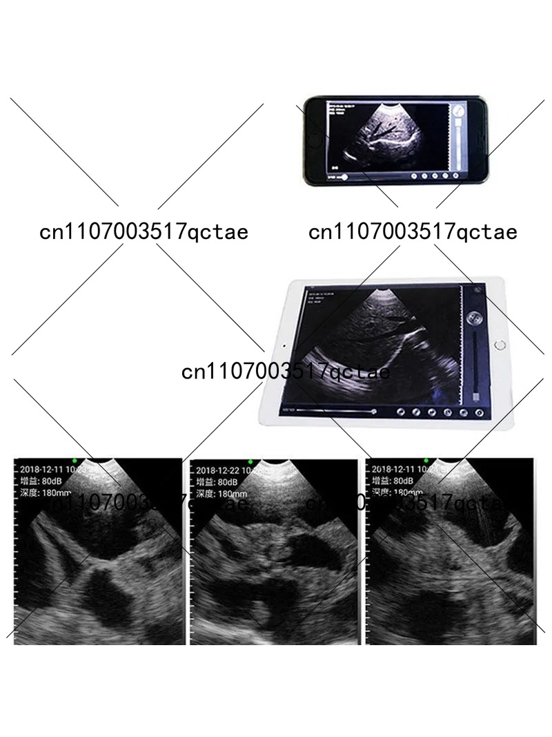 Escáner de Ultrasonido Veterin - Livestock Ultrasound Pregnancy reseña y precio