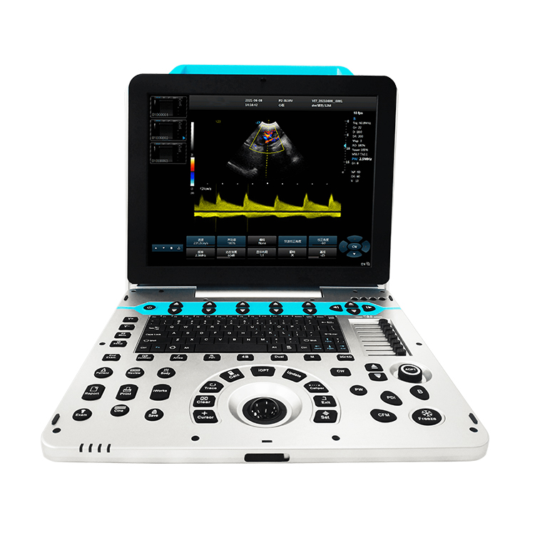 Ultrasonido animal veterinario - Veterinary Ultrasound Scanner Portable reseña y precio
