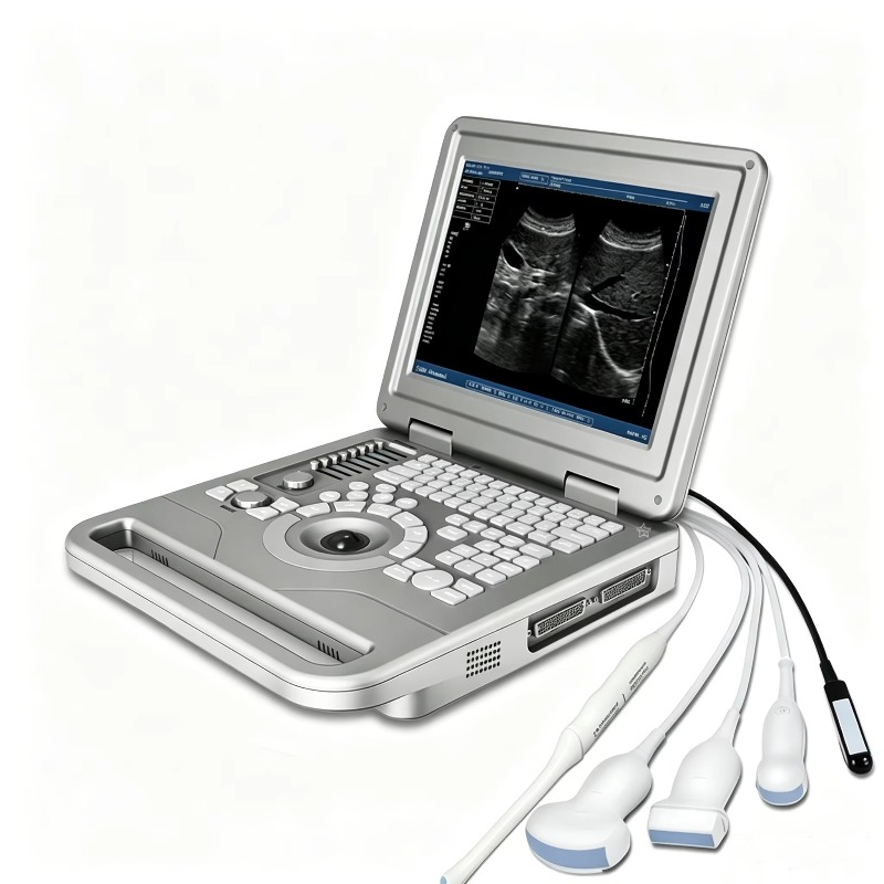 Máquina de Ultrasonido Veterin - Veterinary Ultrasound Scanner Portable reseña y precio