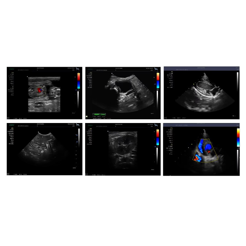 Máquina de Ultrasonido Veterin - Veterinary Ultrasound Scanner Portable reseña y precio