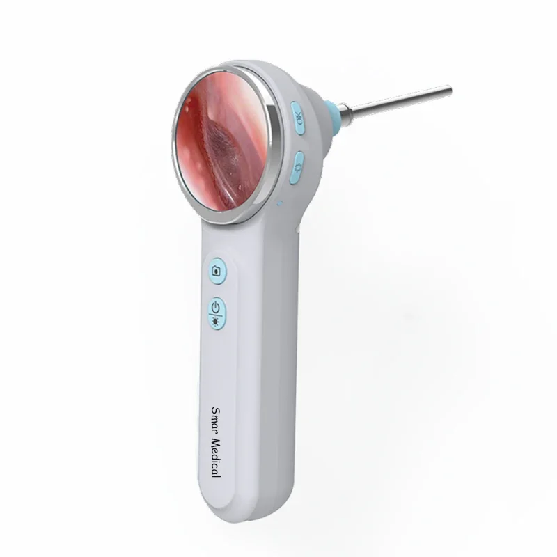 Otoscopio de video veterinario - Veterinary Otoscope reseña y precio