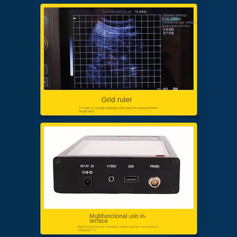 Escáner de Ultrasonido Veterin - Livestock Ultrasound Pregnancy reseña y precio
