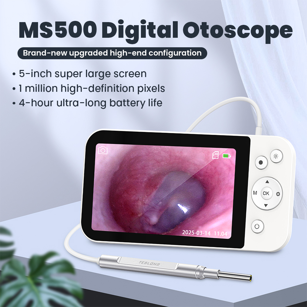 Equipo veterinario Cámara otos - Veterinary Otoscope reseña y precio