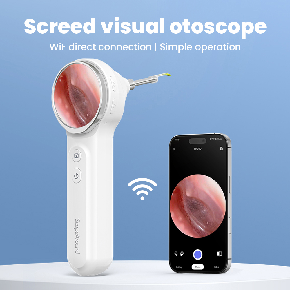 Equipo veterinario Cámara otos - Veterinary Otoscope reseña y precio