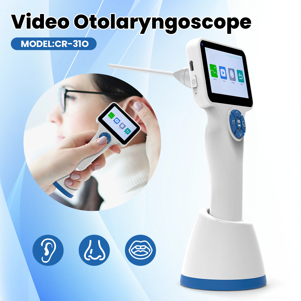 Equipo veterinario Cámara otos - Veterinary Otoscope reseña y precio