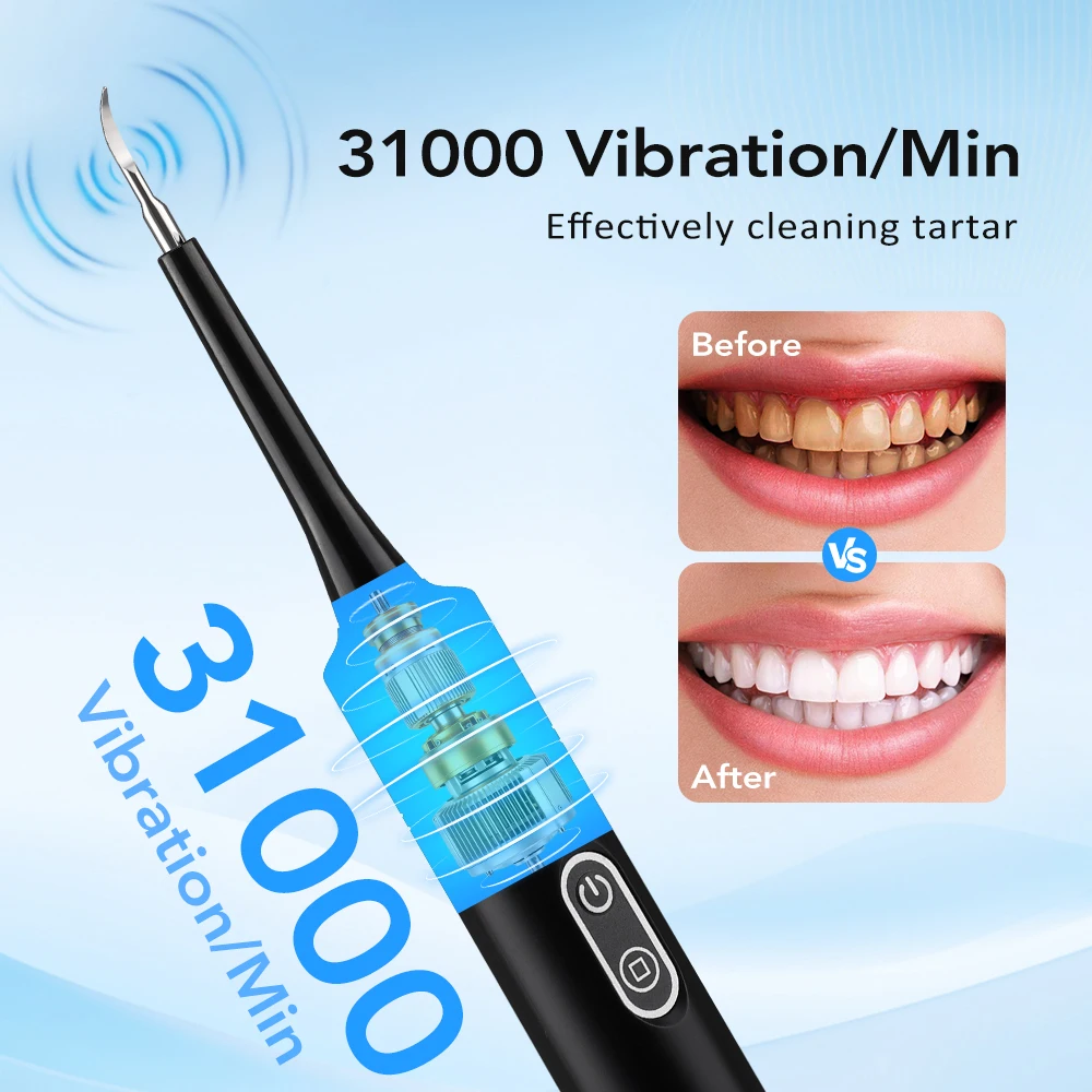 Limpiador Dental Eléctrico con - Veterinary Dental Scaler reseña y precio