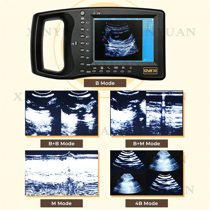 Máquina de Ultrasonido Portáti - Livestock Ultrasound Pregnancy reseña y precio